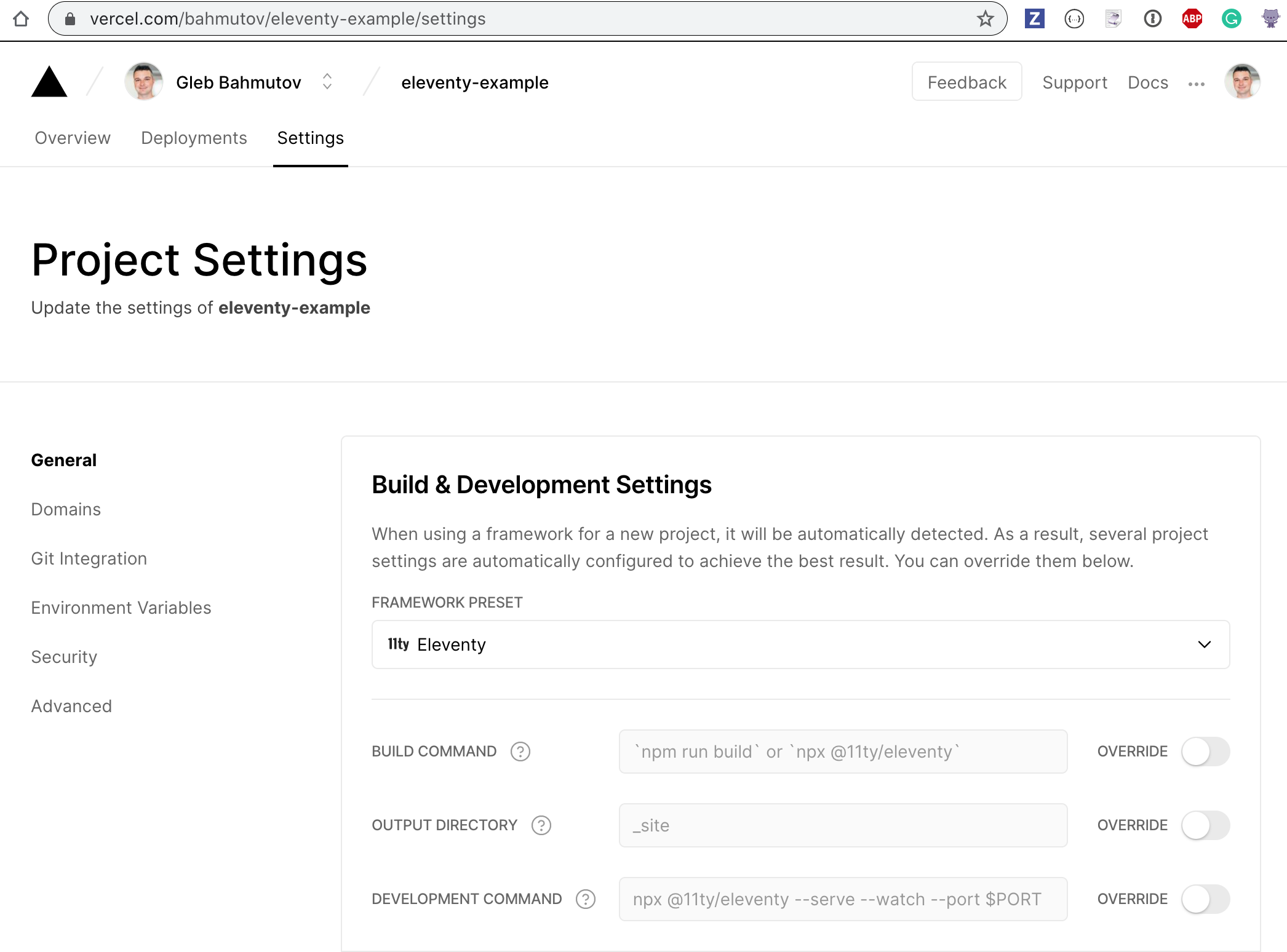 Vercel project settings page